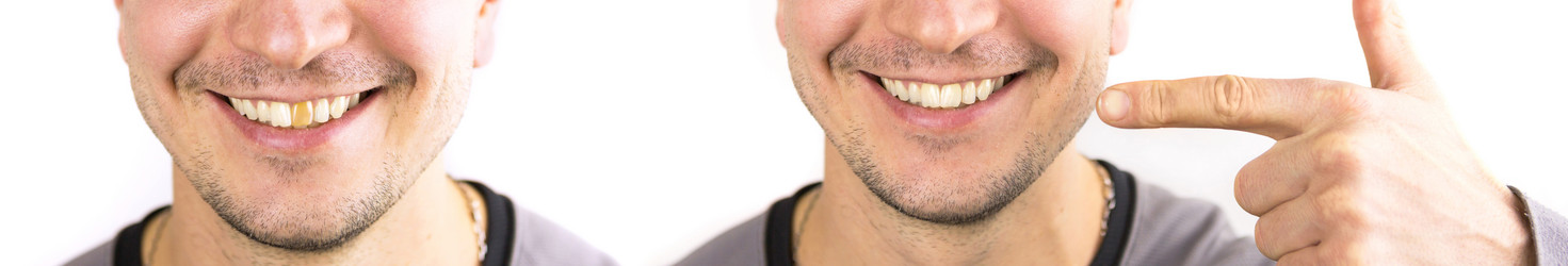 Similar image 21088025