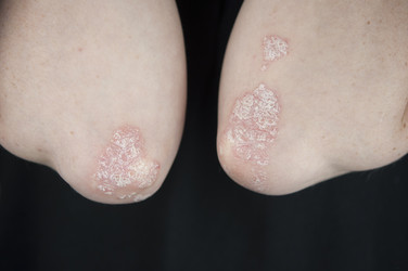 Similar image 21089779