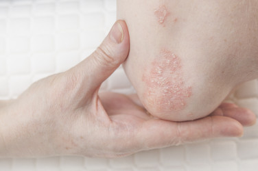 Similar image 21089511