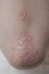 Similar image 21089522