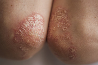 Similar image 21090096