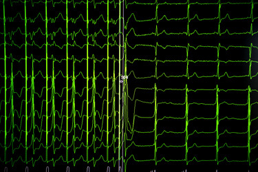 Similar image 21081623