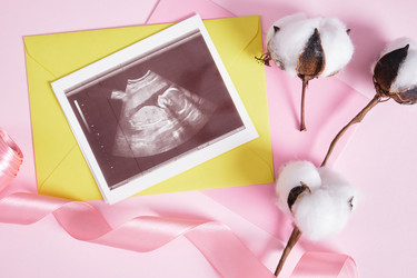 Similar image 21102167