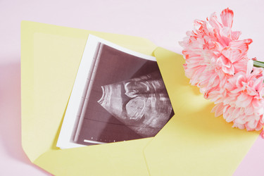 Similar image 21101882