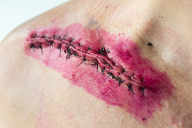 Similar image 21121707