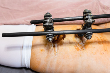 Similar image 21156465