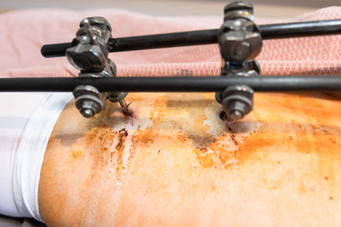 Similar image 21156467