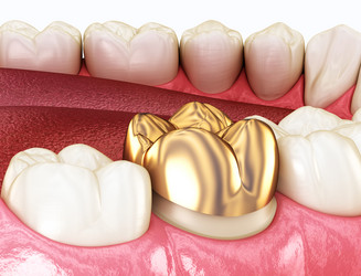 Similar image 21181300