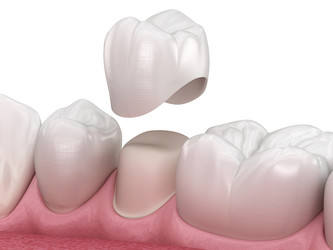 Similar image 21181309