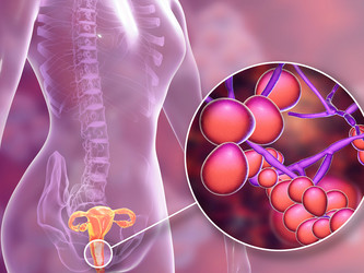 Similar image 21181313