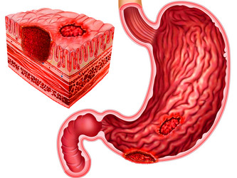 Similar image 21181314