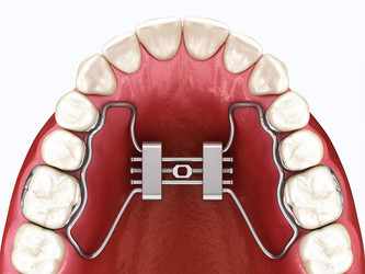 Similar image 21181319