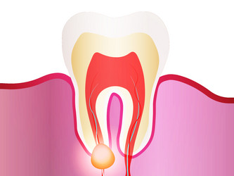 Similar image 21181323