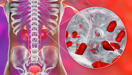 Similar image 21184106