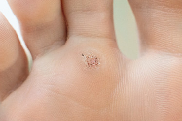 Similar image 21206903