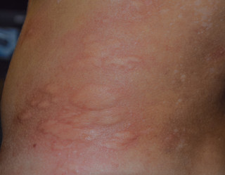 Similar image 21248590