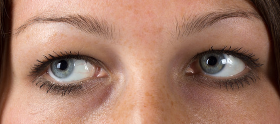 Similar image 21292393