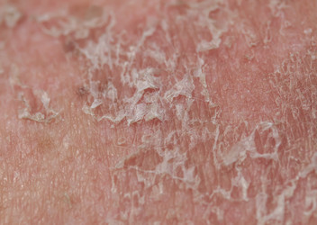 Similar image 21279401