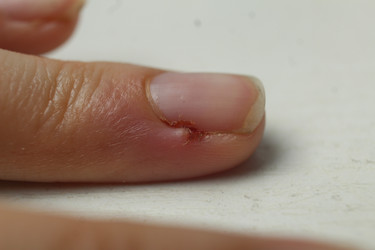 Similar image 21276764