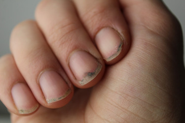 Similar image 21277264