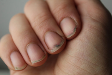 Similar image 21317258