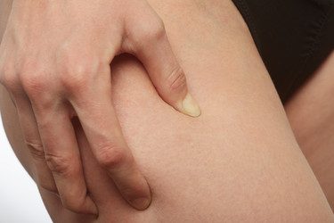 Similar image 21380525