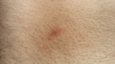 Similar image 21374586