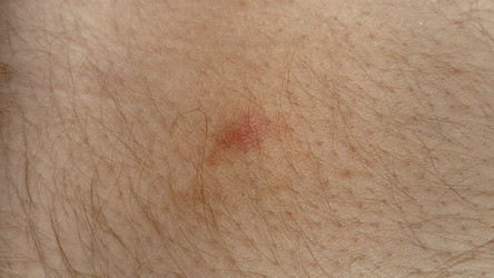 Similar image 21374781