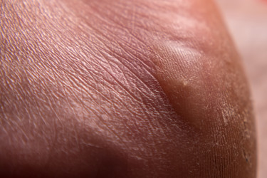 Similar image 21358009