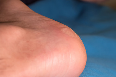 Similar image 21352612