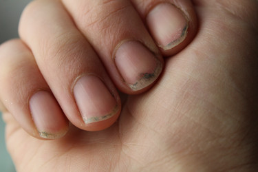 Similar image 21412304