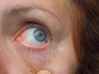 Similar image 21417828