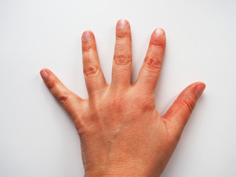 Similar image 21415560