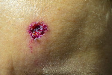 Similar image 21434394