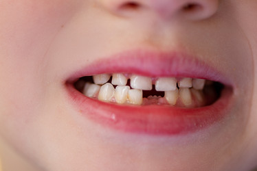 Similar image 21440330