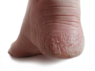 Similar image 21453284