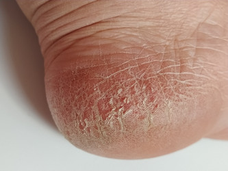 Similar image 21450066