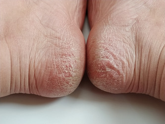 Similar image 21450067