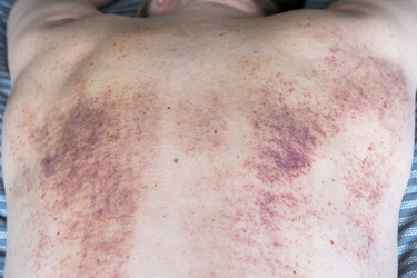 Similar image 21490285