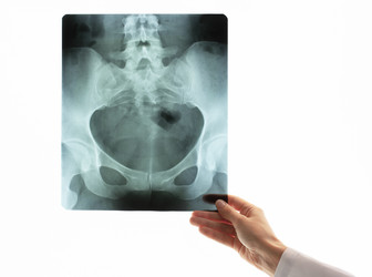 Similar image 21498835