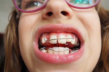 Similar image 21500654