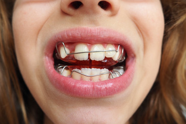 Similar image 21500656