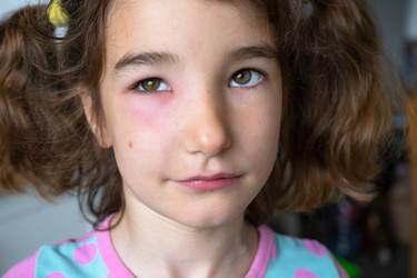 Similar image 21519603