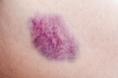 Similar image 21535563