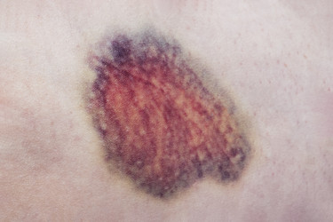 Similar image 21547828