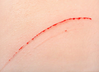 Similar image 21672778