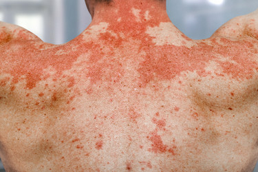 Similar image 21672782