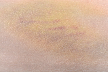 Similar image 21673498