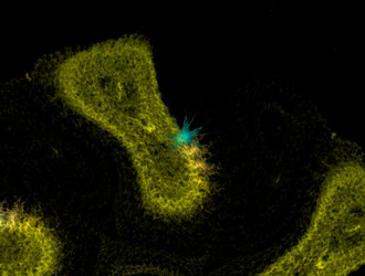 Similar image 21695011