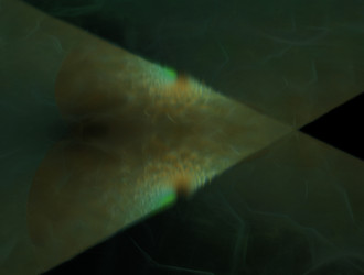 Similar image 21700432